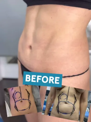instag-bxa-belly